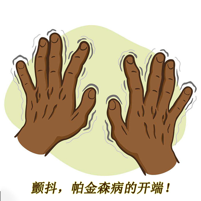 顫抖，帕金森病的開端 帕金森的早期癥狀